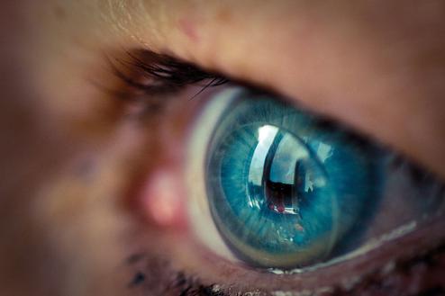Scharf sehen knnte bald zur Nebenfunktion von Kontaktlinsen werden (Bild: Niek Beck/Flickr CC-By)