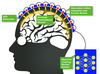 Preview von Prinzip der transcranialen Stimulation